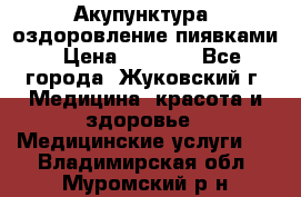 Акупунктура, оздоровление пиявками › Цена ­ 3 000 - Все города, Жуковский г. Медицина, красота и здоровье » Медицинские услуги   . Владимирская обл.,Муромский р-н